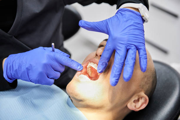Best Urgent Care for Lost Fillings or Crowns in Woodlawn, OH